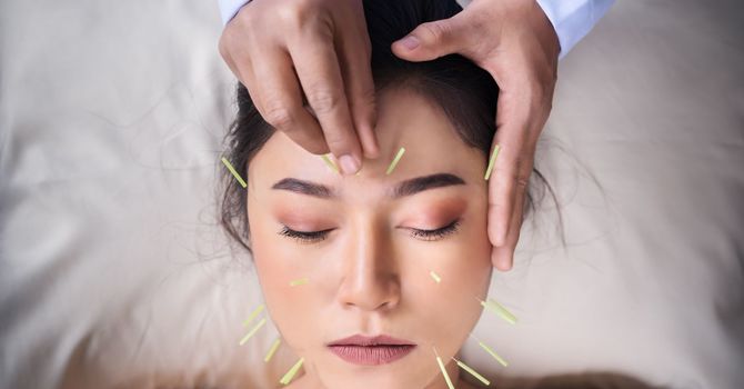 My Path to Becoming a Traditional Chinese Medicine Practitioner image