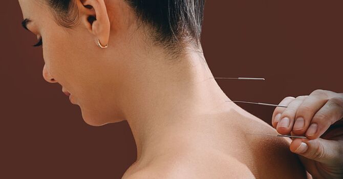 My Path to Becoming a Traditional Chinese Medicine Practitioner image